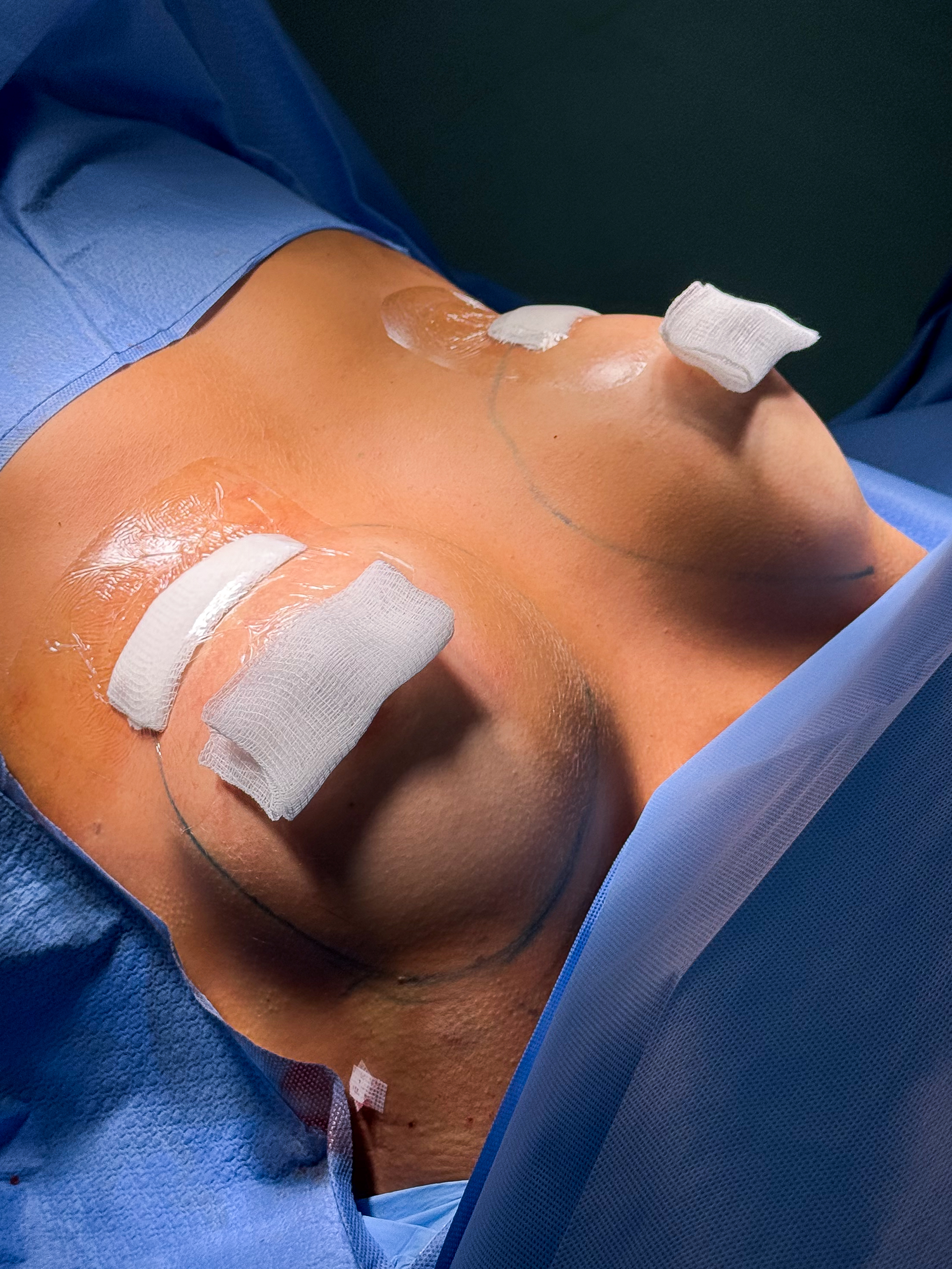 Dr. Breno em Cirurgia